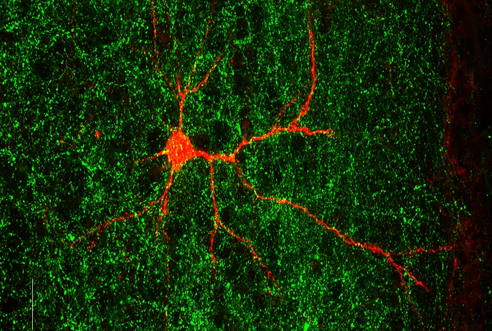 neurons stained red and green